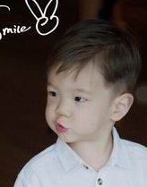 子宫畸形试管婴儿双胞胎容易畸形吗？