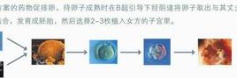 四川地区有哪些私立的机构可以做试管技术？2026年生三胎补助2万吗？怎么领？